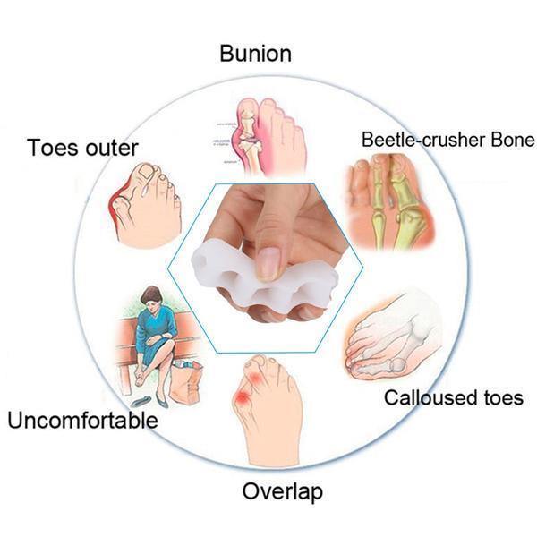 Orthopedic Bunion Corrector and Toe Separator