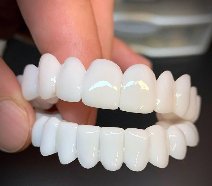 Aesthetic Dental Prosthesis for Natural Smile Restoration