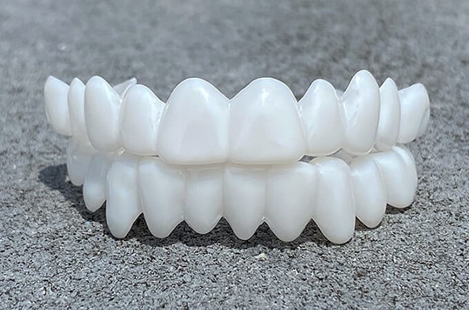 Aesthetic Dental Prosthesis for Natural Smile Restoration
