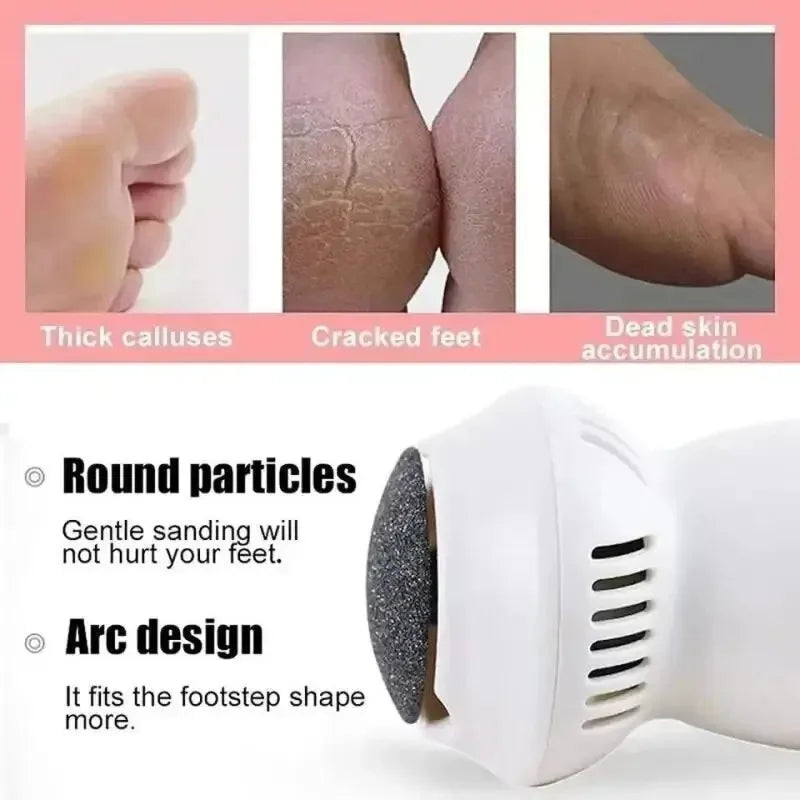 Electric Callus Remover with Suction System for Smooth Feet