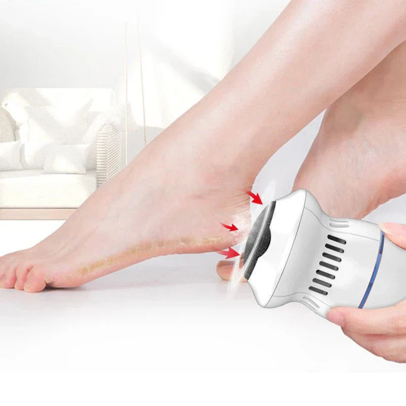 Electric Callus Remover with Suction System for Smooth Feet