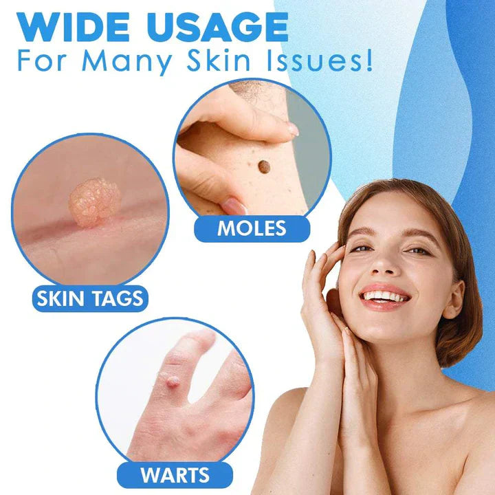 Pain-Free Skin Tag and Wart Removal Set