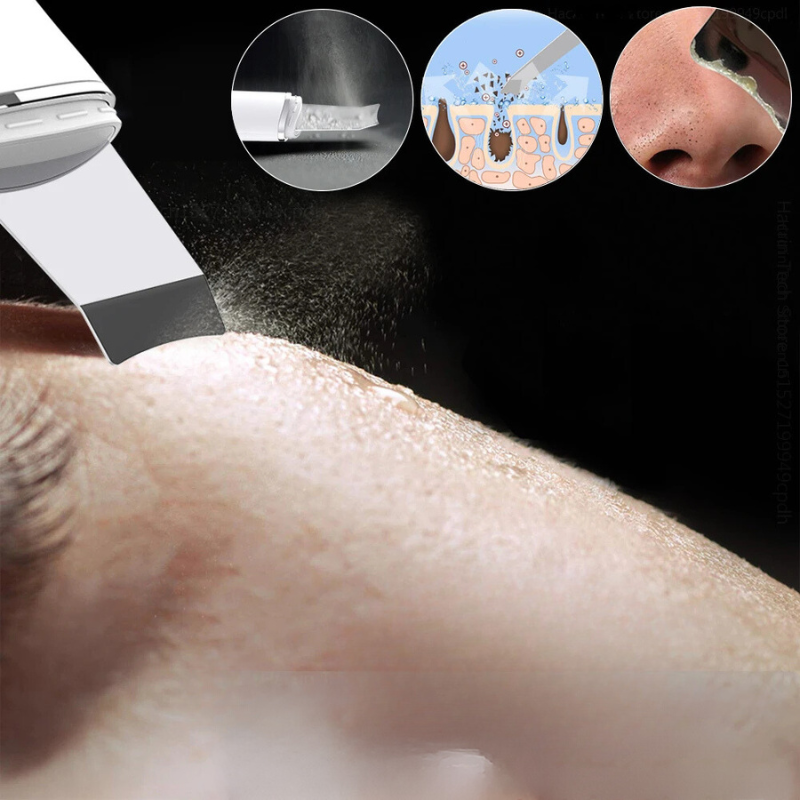 Deep Cleansing Facial Exfoliator with Ultrasound and EMS Microcurrent