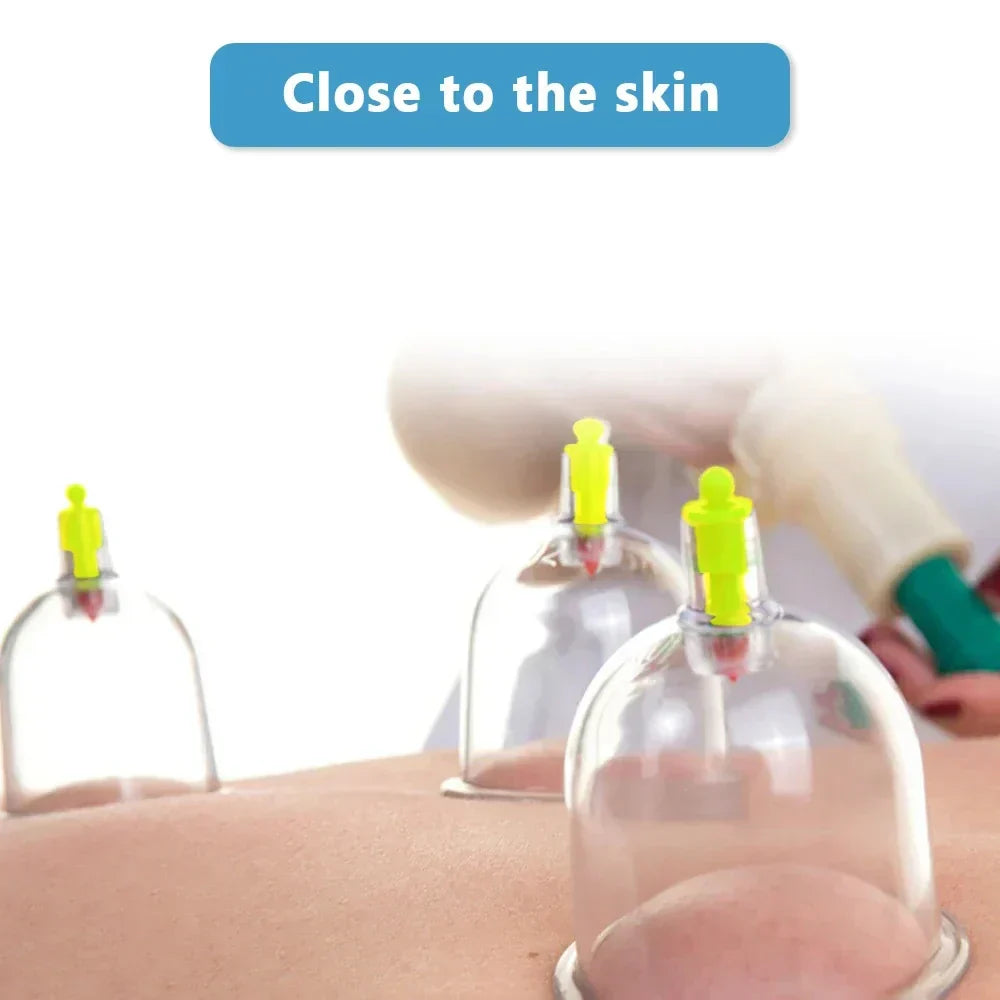 Vacuum Cupping Therapy Set for Muscle Relief