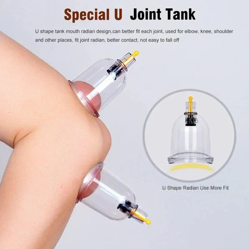 Vacuum Cupping Therapy Set for Muscle Relief